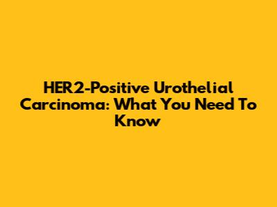 HER2-Positive Urothelial Carcinoma: What You Need To Know