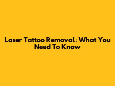 Laser Tattoo Removal: What You Need To Know
