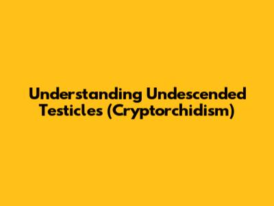 Understanding Undescended Testicles (Cryptorchidism)